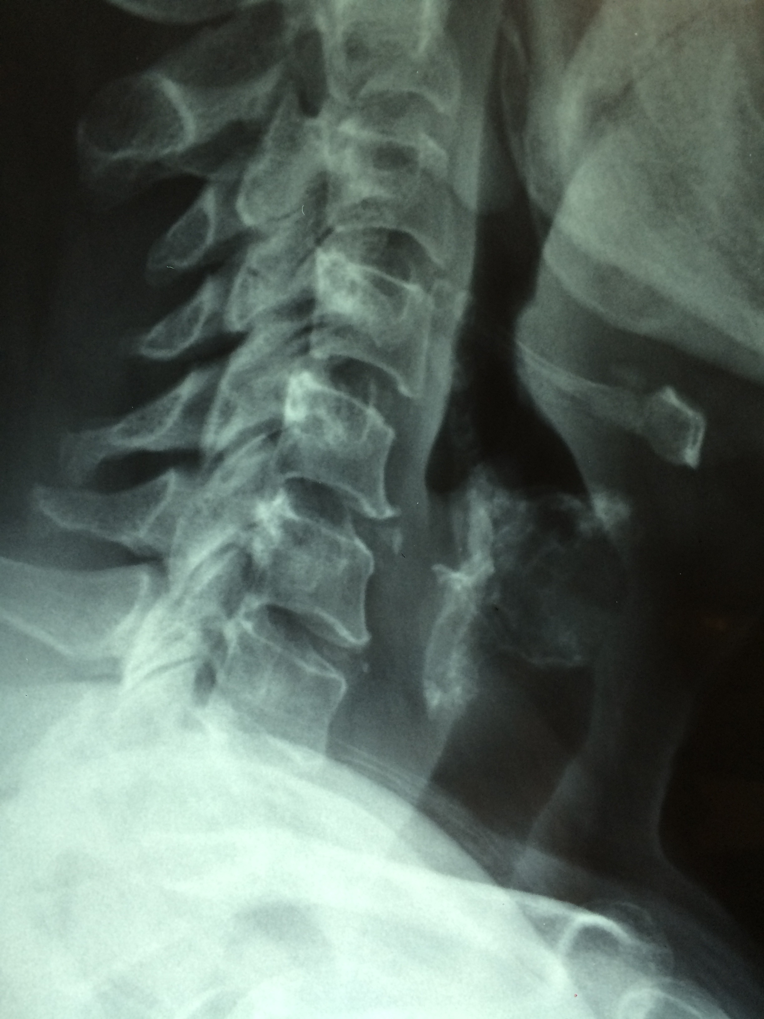 Disease examination oncology